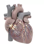 Atrial Fibrillation Heart