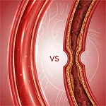 Healthy and Unhealthy Arteries