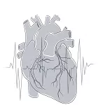 Cardiogenic