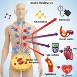 Insulin Resistance