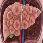 Liver and Diabetes