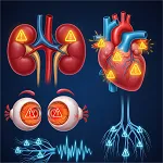 Diabetes Complications