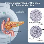 Insulin and Pancreas
