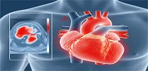 Blood Flow in Heart Failure