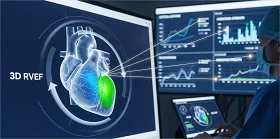 3D RVEF and Cardiovascular Surgery Outcomes