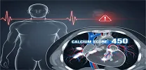 CAC and Heart Failure Risk