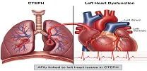 AF and PH