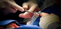 Bleeding Risk After TAVI: New Criteria Reveal Who’s Most Vulnerable