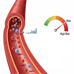 APO LIPO