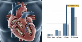 Blue Cross Blue Shield of Michigan Cardiovascular Consortium 2 risk score 