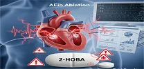 Atrial Fibrillation