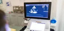 Apical vs Non-Apical HCM: Which Patients Face Safer Cardiovascular Outcomes?