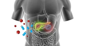 Diabetes and Pancreatic Cancer Risk
