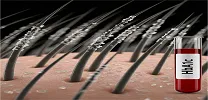 Skin Glycation and Diabetes