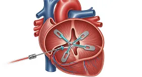T-TEER in Tricuspid Regurgitation