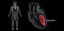 left ventricular failure