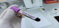 Helicobacter pylori linked to  cardiovascular disease, liver dysfunction, and type 2 diabetes