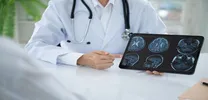 Extended Noninvasive Monitoring Detects Clinically Significant Arrhythmias After Stroke