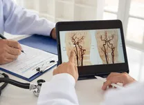 Non-Ischemic Heart Failure Patients Show Strongest Response to CRT Upgrade