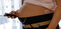 Automated Insulin Delivery Improves Glycemic Control in Type 2 Diabetes Regardless of C-Peptide
