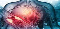 Hypertension