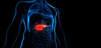 MR Imaging Reveals Distinct Liver Fat Profiles Across Diabetes Subtypes