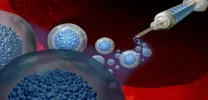 islet Cell