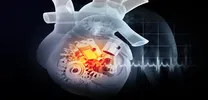Not All TAVI Valves Are Equal: Self-Expanding Platforms Show Better Outcomes
