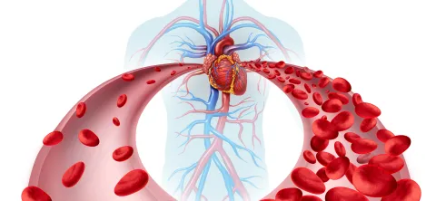 Drug-Eluting Resorbable Scaffold Improves Long-Term Outcomes in CLTI