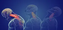 Nomogram Predicts Osteoporotic Fracture Risk in Type 2 Diabetes