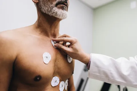 V8 ECG Improves Accuracy of CRT Lead Positioning