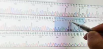 λ Pattern on ECG Enhances Neonatal Bradycardia Diagnosis