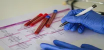 Non-opioid Therapy Pilavapadin Shows Promise for Diabetic Neuropathic Pain