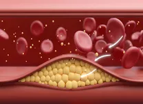 Missed Lipid Checks Linked to Higher Cardiovascular Risk in CAD Patients