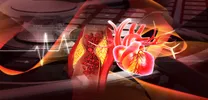 Once-Weekly GLP-1 RAs Reduce Cardiovascular Events and Costs in T2D with ASCVD