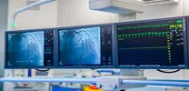 REBOOT Trial Questions Routine Beta-Blocker Use After MI