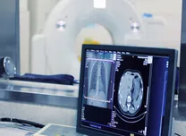 Artificial Intelligence Unlocks Hidden Insights in Cardiovascular Lipid Management