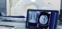 imaging of pericoronary adipose tissue (PCAT) for risk prediction in acute coronary syndrome (ACS)