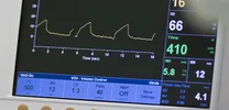 CRT Predictors