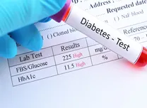 Gradual Rise in Post-Dexamethasone Cortisol Linked to Cardiometabolic Burden in T2D