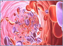 MicroRNA Signatures Distinguish Idiopathic Pulmonary Arterial Hypertension From Eisenmenger Syndrome