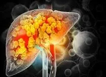 Hepatic Insulin Resistance and Low Beta-Cell Function Mark Highest Risk Subtypes for Type 2 Diabetes
