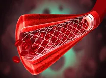 Balloon Pulmonary Angioplasty Remains Safe but Less Effective in High-PAWP CTEPH