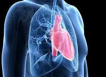 Selexipag Shows Real-World Efficacy and Safety in Pulmonary Arterial Hypertension