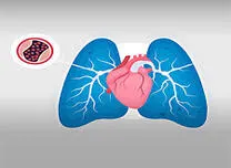 Residual Pulmonary Hypertension Predicts Poor Outcomes After Mitral Valve Repair