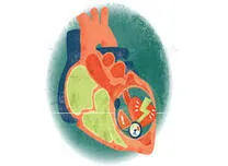 Comorbidities Strongly Influenced Quality of Life in Heart Failure