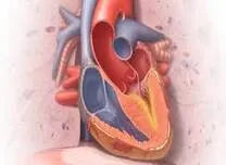 Recurrent MYBPC3 Variants Show Indolent Clinical Course in Hypertrophic Cardiomyopathy