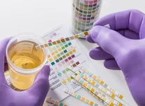 Integrated Clinical–Biomarker Calculator Improves Precision in Monogenic Diabetes Diagnosis 