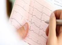 Simple ECG Marker Accurately Identifies Culprit Artery in Inferior Myocardial Infarction
