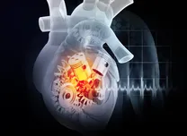 Magnetically Levitated LVAD Significantly Reduces Stroke and Bleeding Events 